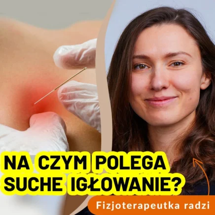 Suche igłowanie- co to jest, kto może skorzystać i na jakie efekty można liczyć?